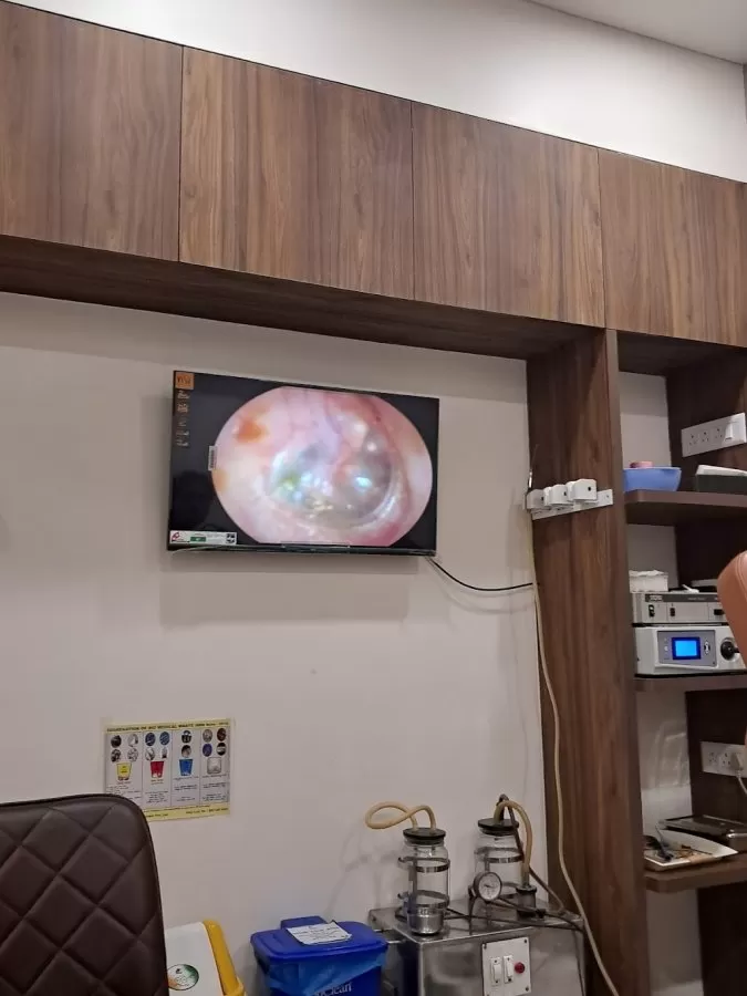 Aashwi ENT Clinic Chandlodiya, Ranip, Gota, Ahmedabad | ENT, Ear, Nose, Throat, Vertigo, Snoring Treatment - Photo 3