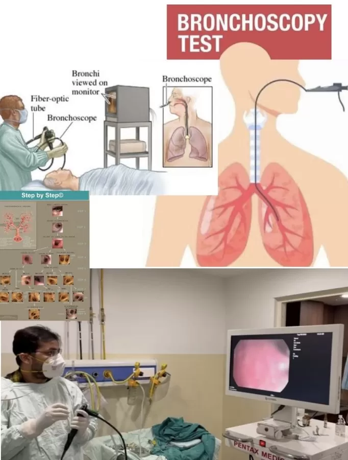 Dr Varun Rajpal | Best Pulmonologist in Noida/Greater Noida/Lungs,Chest Specialist, Allergy,Critical Care, Sleep Apnea - Photo 2