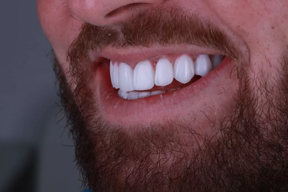 Smile Spa Clinic - Photo 4