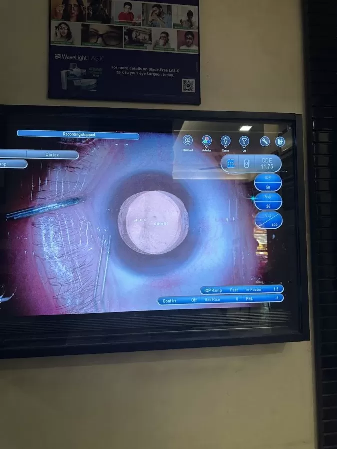Sohum Eye Care Centre | Unit of Dr Agarwals Eye Hospital - Photo 6