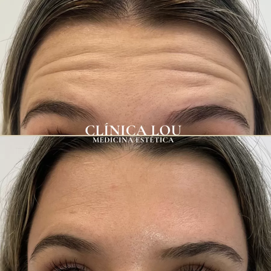 Clínica Lou - Medicina Estética - Photo 6