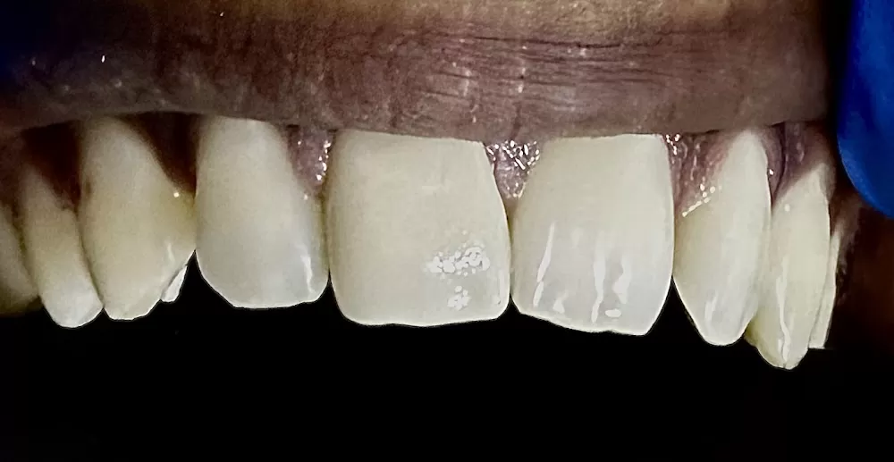 Shukra Dental Centre Mint - Photo 1