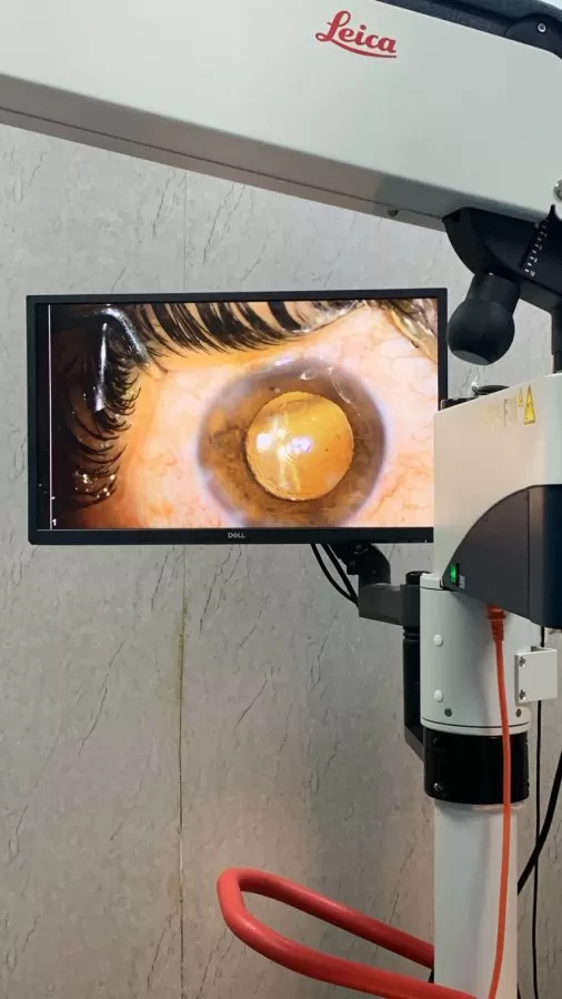 Gaur Vision Laser Eye Centre- Eye Doctor Greater Noida - Photo 4
