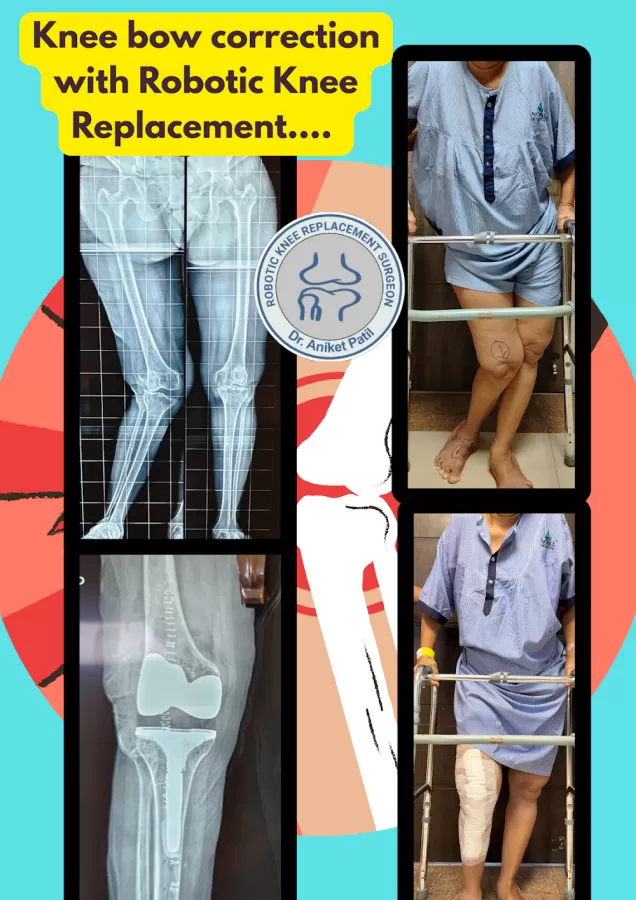 Dr Aniket Patil - Photo 3
