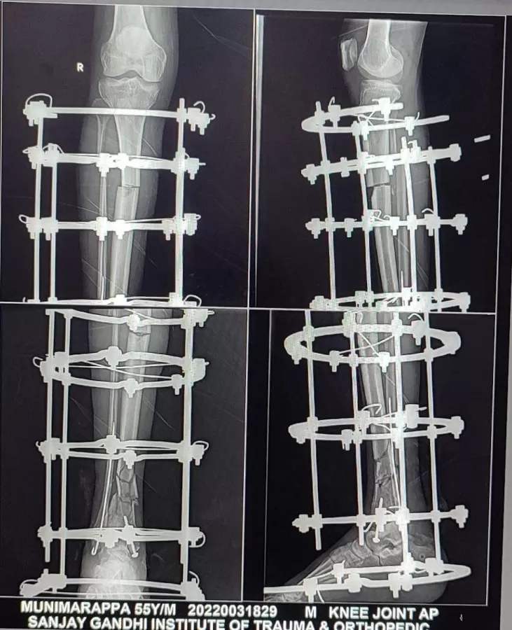 Samarth Ortho Care - Photo 6
