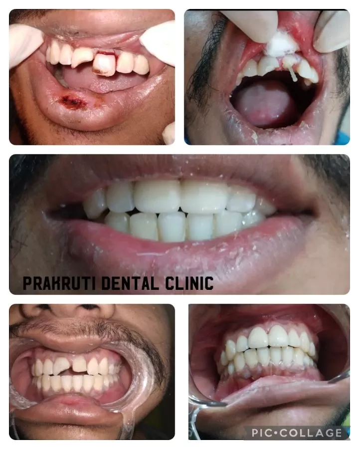 Prakruti Dental Clinic - Photo 3