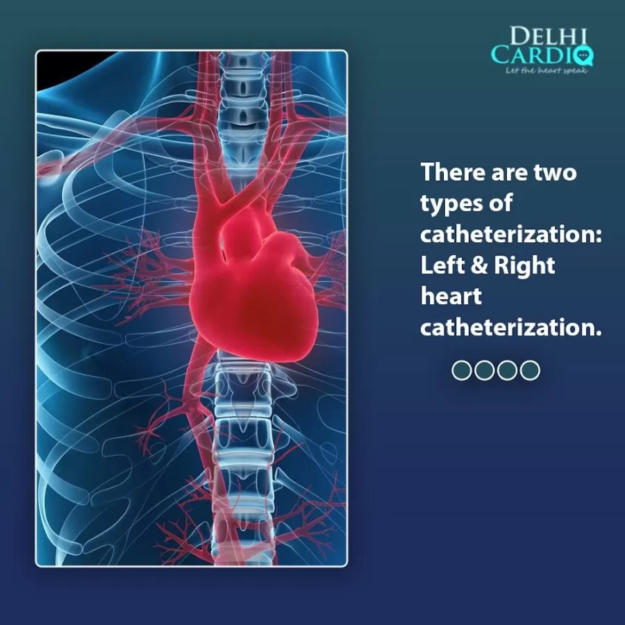 Delhi Cardio | Premium Cardiac Diagnostics at Home | Delhi NCR | North India - Photo 7
