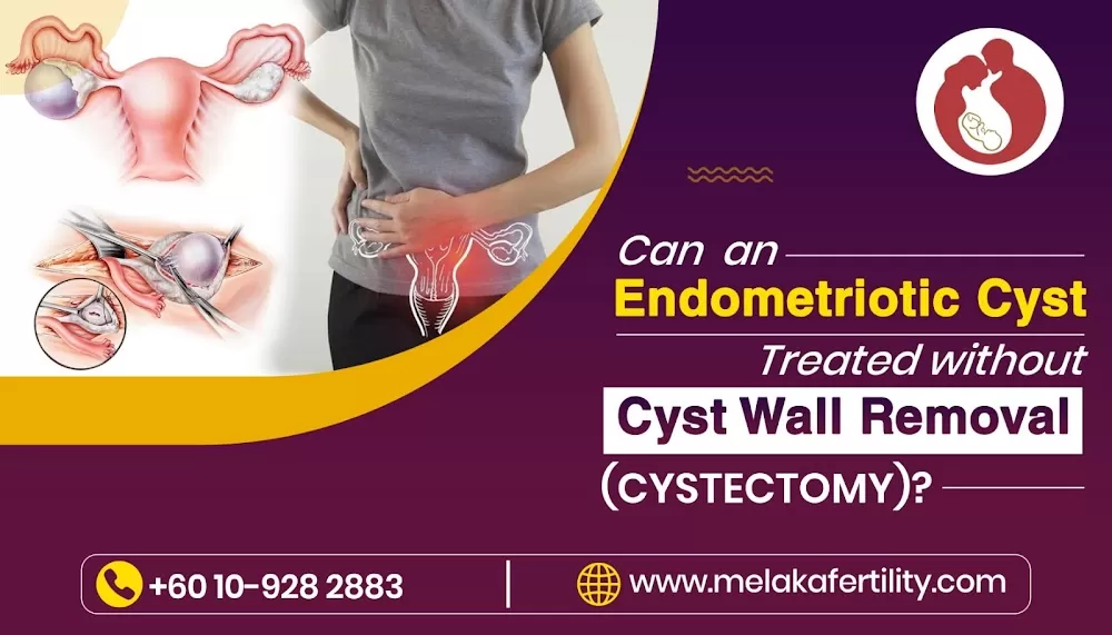 Selva's Fertility, Obstetrics and Gynaecology Clinic - Fibroid Specialist in Malaysia, Adenomyosis Treatment, Klinik Wanita - Photo 2