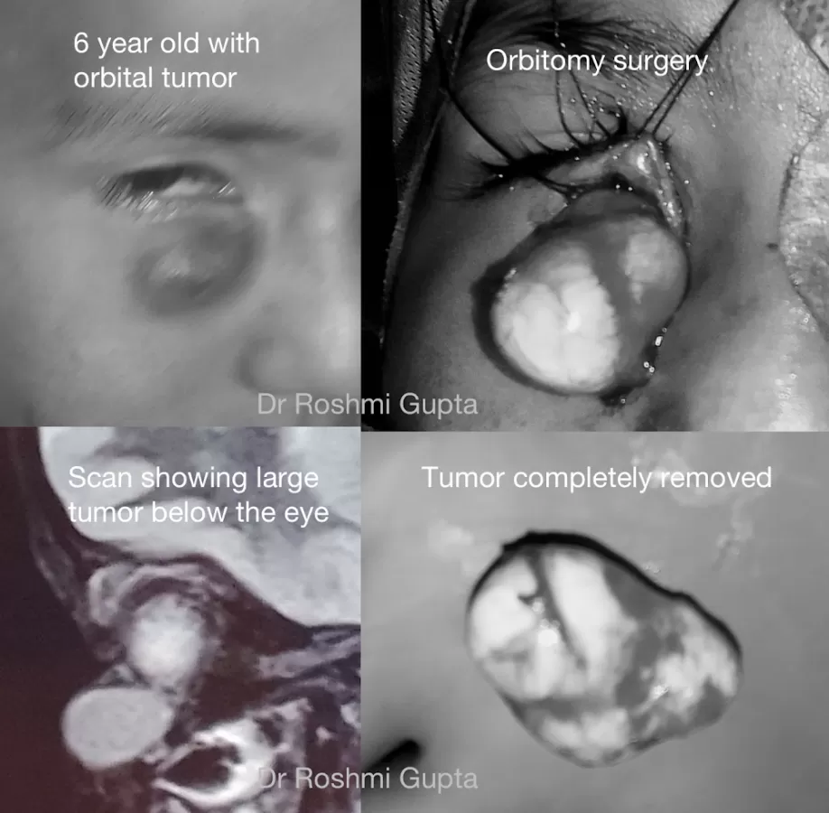 Dr Roshmi Gupta - Photo 5