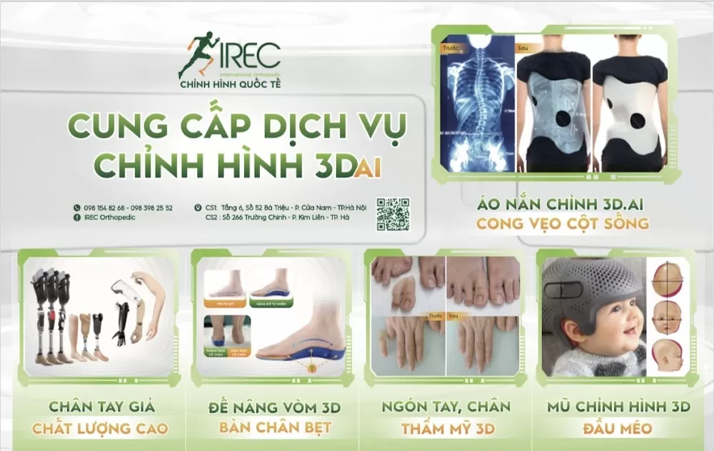 Chỉnh Hình Quốc Tế IREC - Photo 7