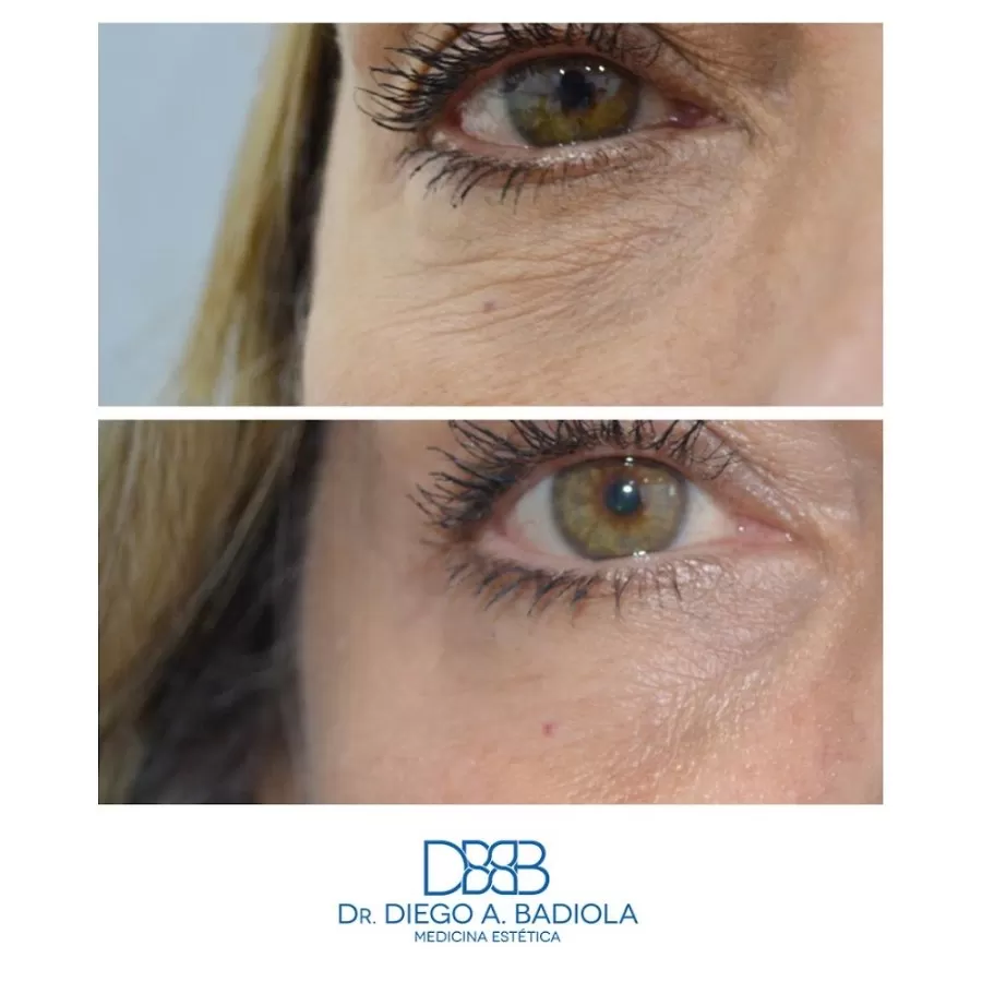 Clínica Dr. Badiola - Medicina Estética - Photo 5