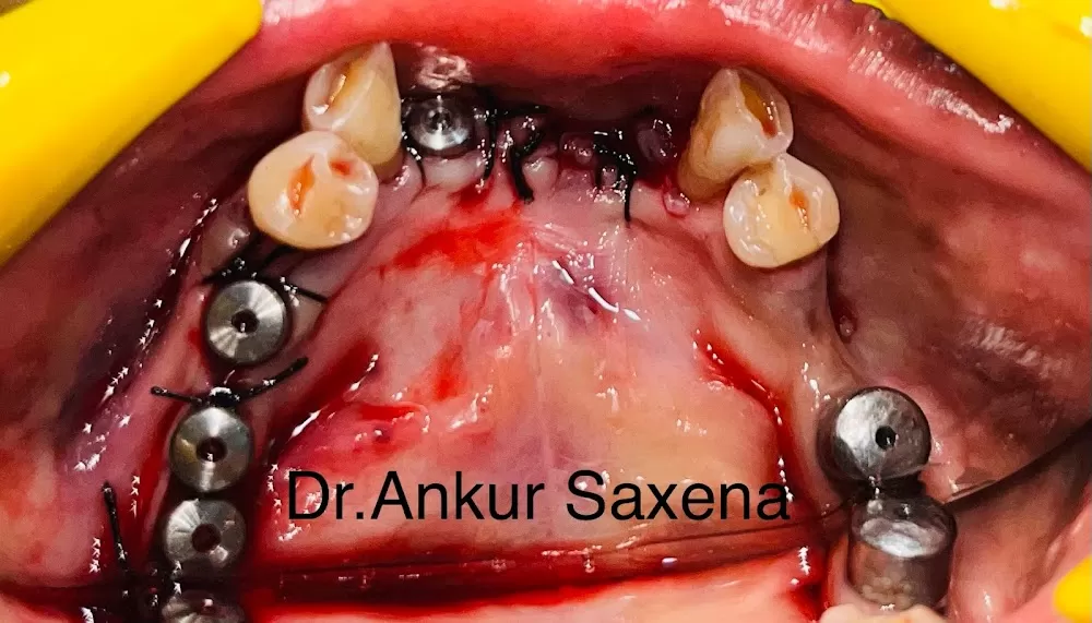 Noida Dental Hospital - Dental clinic | Dentist in Greater Noida - Photo 2