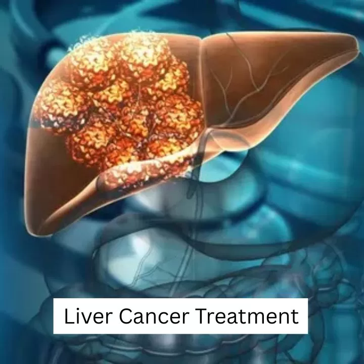 Dr. Gaurav Gupta - Liver Transplant Surgeon in Mumbai | Hepatobiliary Surgeon | HPB Surgeon| Organ Transplant Surgeon Mumbai - Photo 4