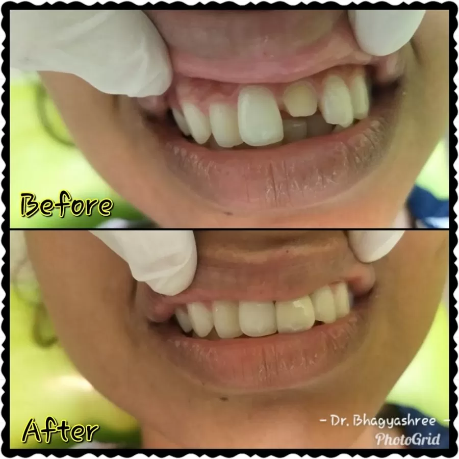 Dental Hub Clinic - Dr.Bhagyashree Mahale - Photo 7