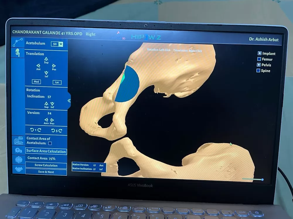 Dr. Aashish Arbat - Best Robotic Knee and Hip Replacement Surgeon in Pune - Photo 2