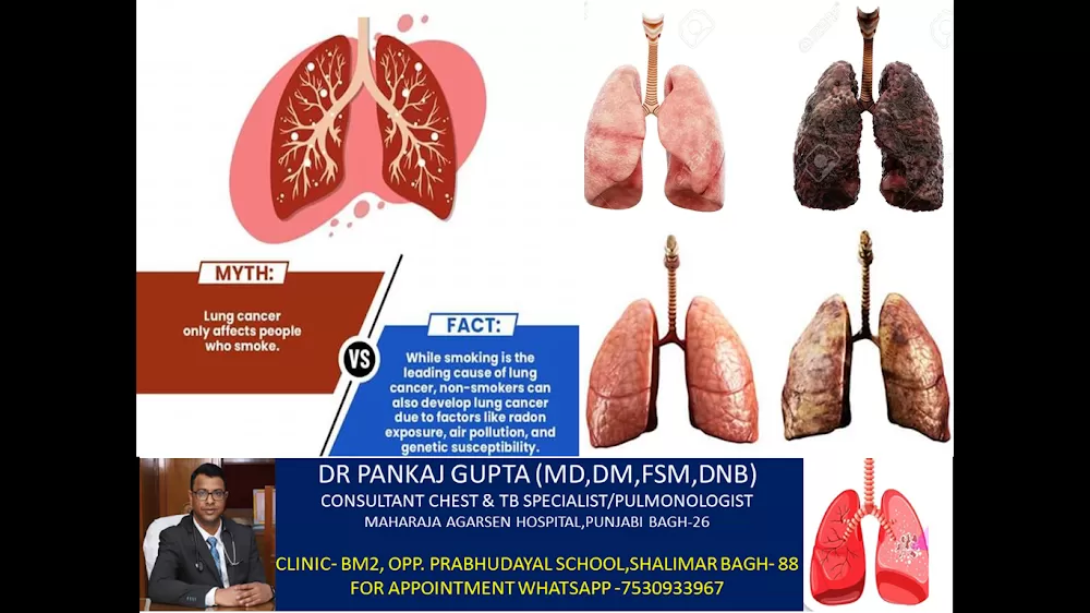 Dr Pankaj Gupta-Best Chest TB lung Specialist doctor Best Asthma Cough ILD doctor in punjabi Bagh - Photo 3