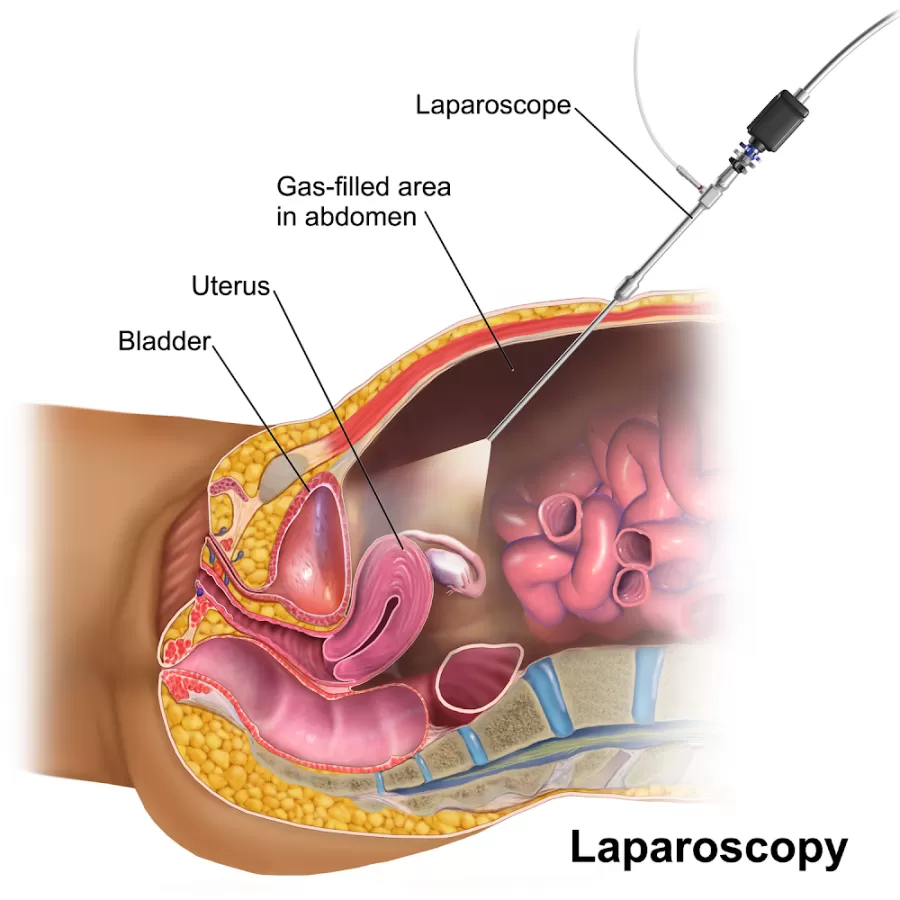 Malti Hospital & Test Tube Baby Centre | IVF Hospital | Test Tube Baby Hospital | Infertility Treatment | IVF | Bhopal - Photo 2