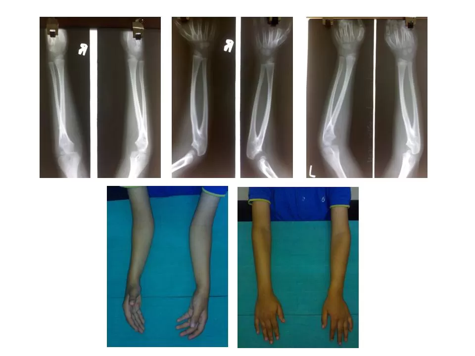 Diabetic Foot & Podiatrist - Visa Medicure - Dr.T.V.Raja - Photo 7