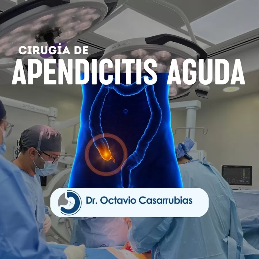 Cirugía gastrointestinal Cancun - Photo 3