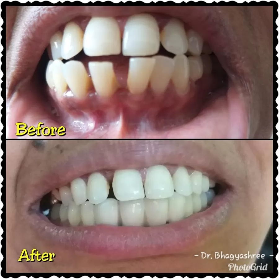 Dental Hub Clinic - Dr.Bhagyashree Mahale - Photo 6