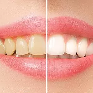 Shukra Dental Centre Mint - Photo 8