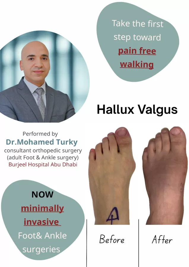 Dr. Mohamed Turky,(Orthopedic Foot and ankle surgeon). - Photo 2