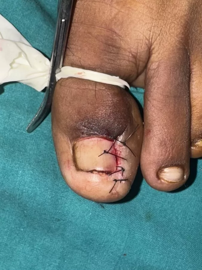 Hand Surgeon Dr Gaurav Pagare - Photo 4
