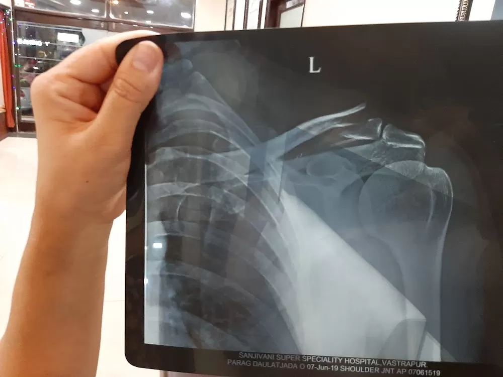 Arihant Knee Replacement Hospital –Hip Replacement Surgeon Ahmedabad,Gujarat |Ligament Surgery|Total Knee Replacement Surgery - Photo 5