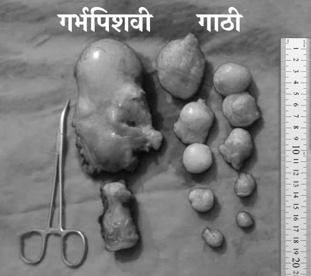 Bhadane Maternity Hospital - Photo 6