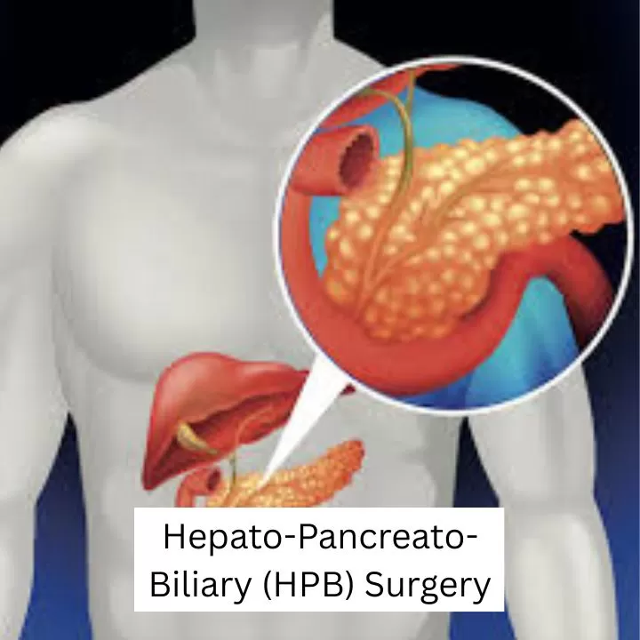 Dr. Gaurav Gupta - Liver Transplant Surgeon in Mumbai | Hepatobiliary Surgeon | HPB Surgeon| Organ Transplant Surgeon Mumbai - Photo 6