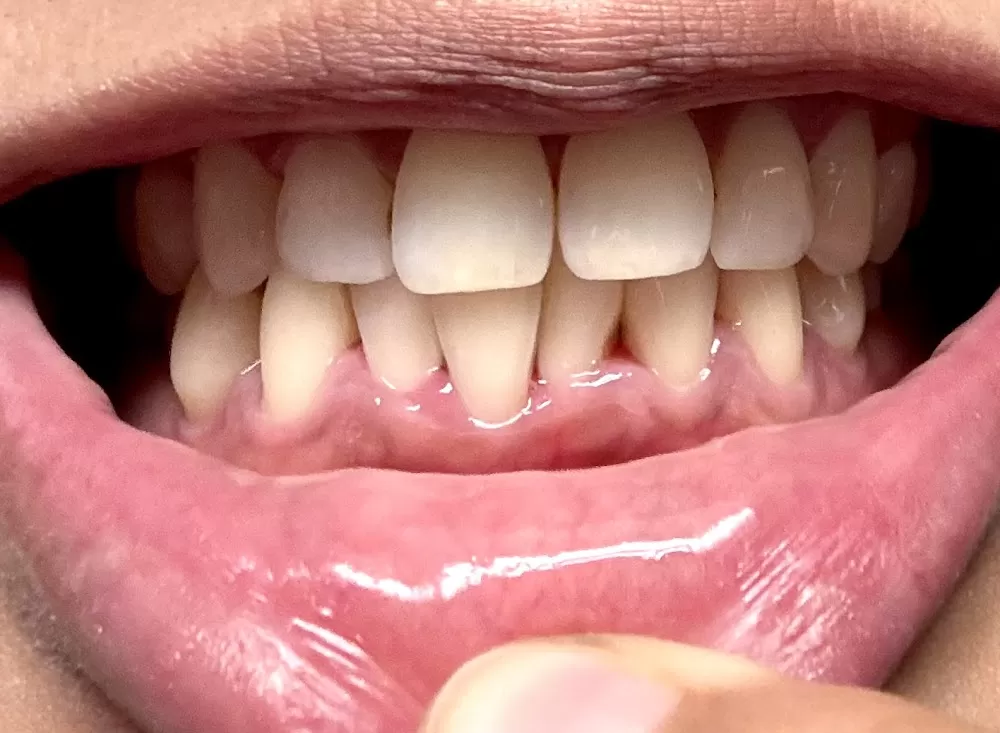 Picasso Dental Clinic Hanoi (Chau Long Branch) - Photo 3