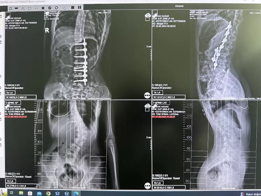 orthopedic surgery, spine surgery - Photo 2