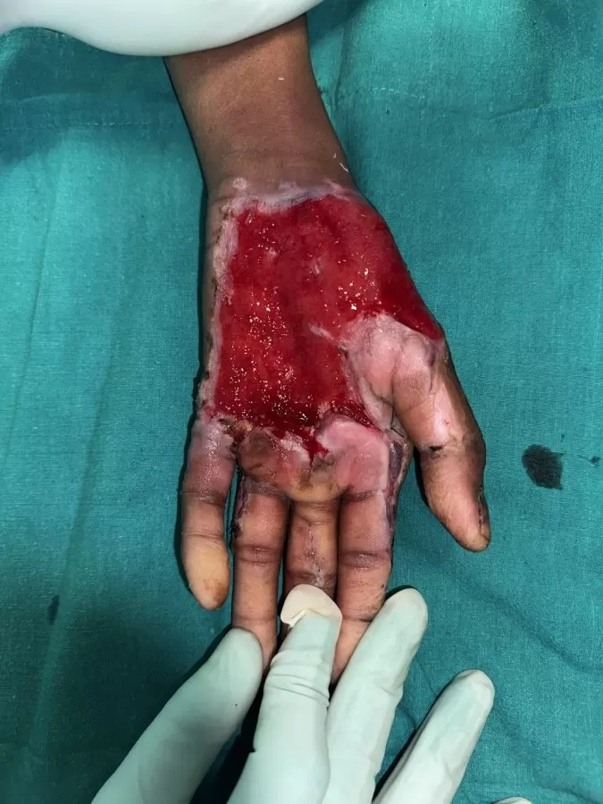 Hand Surgeon Dr Gaurav Pagare - Photo 8