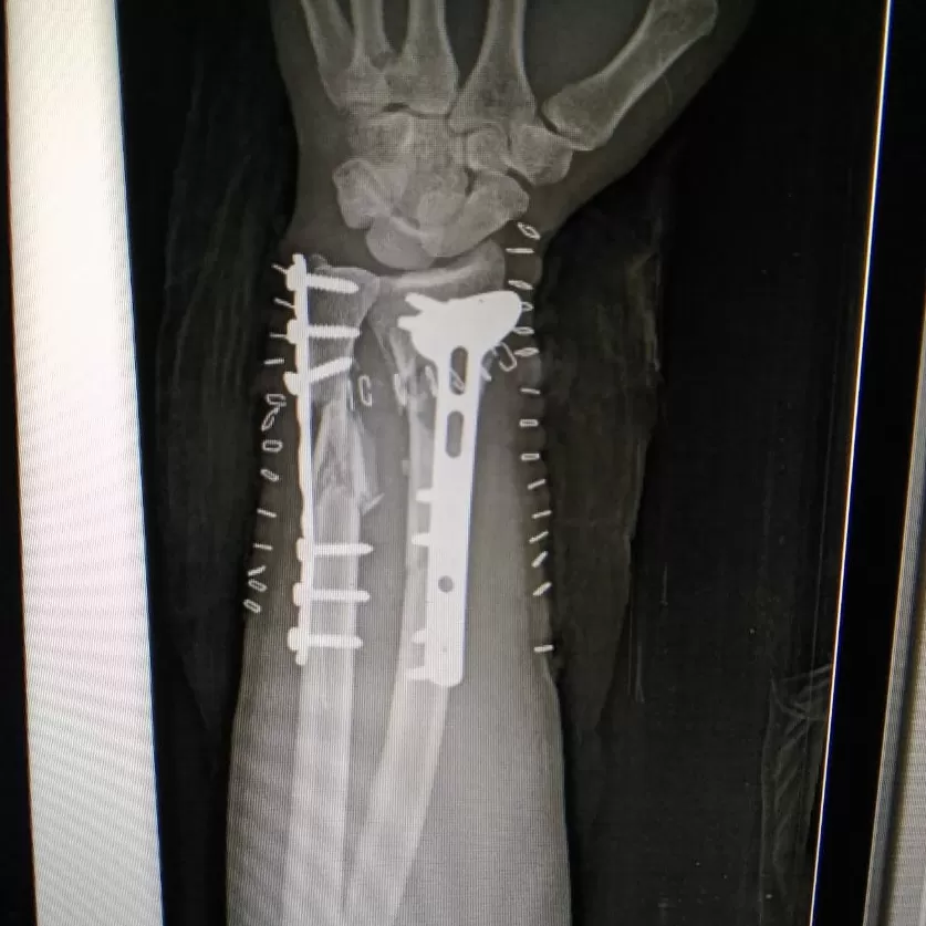 Samarth Ortho Care - Photo 3