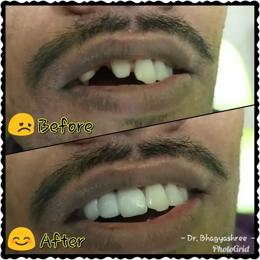 Dental Hub Clinic - Dr.Bhagyashree Mahale - Photo 5