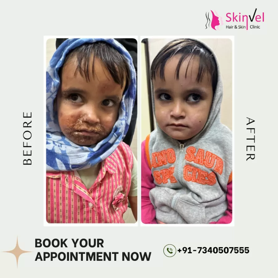 SkinVel- Hair & Skin Clinic - Photo 7