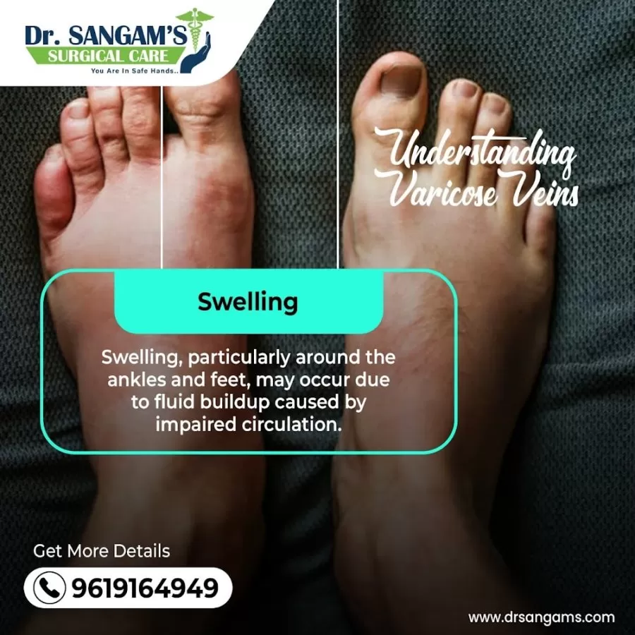 Dr. Gaurav Sangam (Proctologist) - Piles Doctor in Chembur | Fissure, Fistula, Circumcision, Hernia, Appendix | Laser Surgery - Photo 5