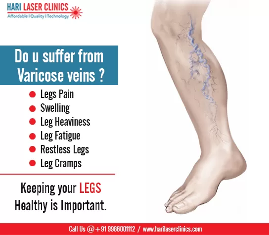 Hari Laser Clinics - Piles, Varicose Veins, Fistula, Fissure - Lipoma - Gynecomastia - Circumcision - Laparoscopic Surgery - Photo 6