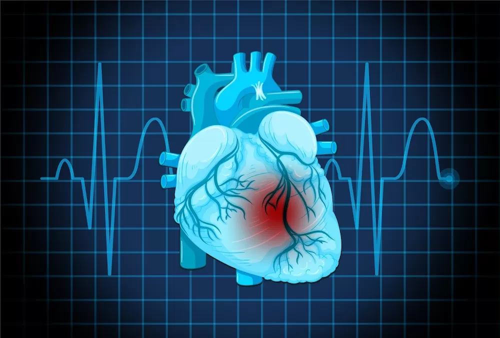 Department of Cardiology || Apollo Hospital Jayanagar - Photo 8