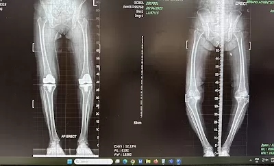 Dr Tan Chun Ee Orthopedic, Spine & Pain Intervention