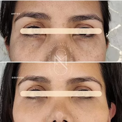 Dra. Sthefanny Mesias | Medicina Estética Avanzada y Rejuvenecimiento Facial