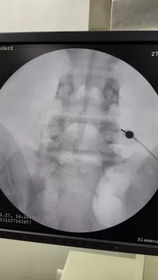 Dr Ravi Suman Reddy | Best NeuroSurgeon in Hyderabad | Best Spine Surgeon