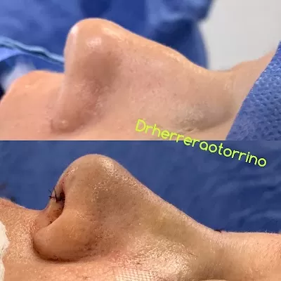 drherreraotorrino