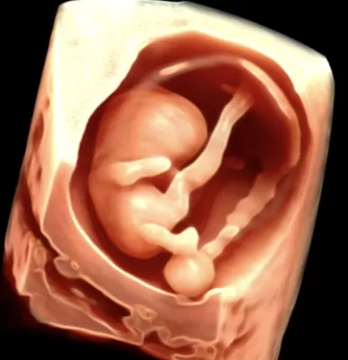 Yorioka Fetus Clinic