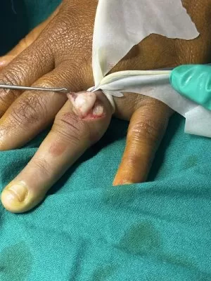 Hand Surgeon Dr Gaurav Pagare
