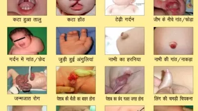 KIDSURG