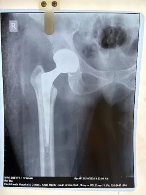 ELECTRICWALA HOSPITAL - Centre For Specialised Orthopaedic, Bone And Joint Surgery