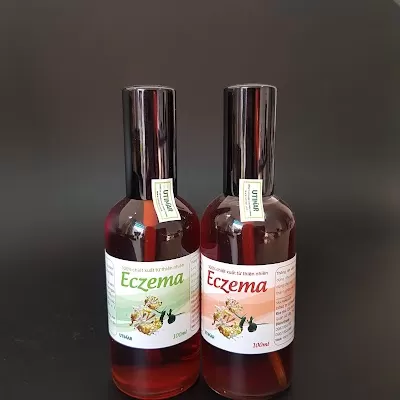 Chữa bệnh chàm bằng đông y