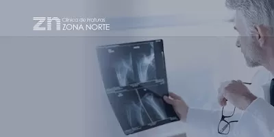 Clínica de Fraturas Zona Norte