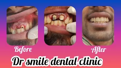 Dr smile Dental Clinic